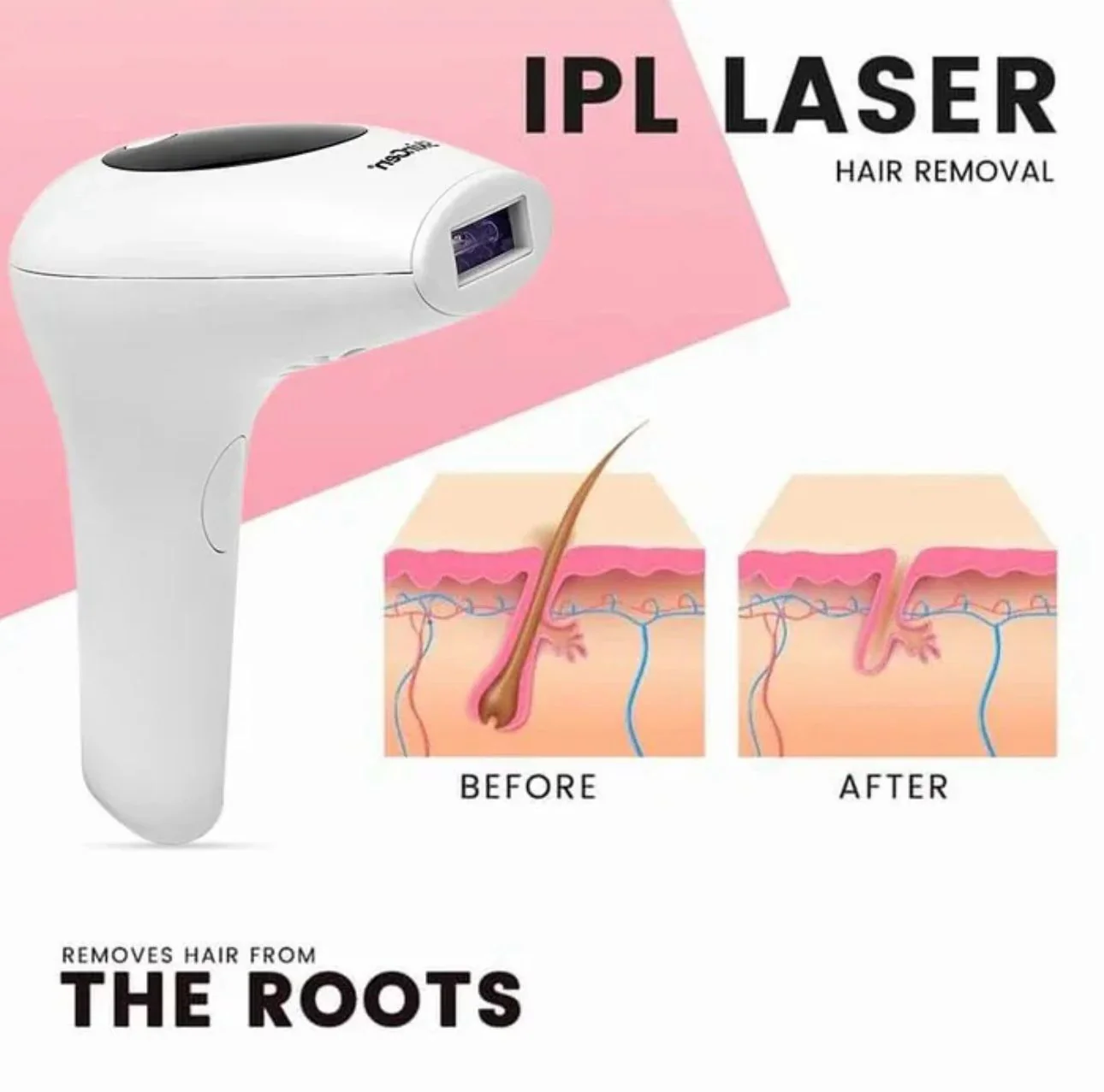 Professional IPL Laser Hair Removal Machine – Painless At-Home Hair Remover for Men & Women | Long-Lasting Results - Image 2